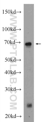 AFP Antibody in Western Blot (WB)