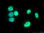 NACC1 Antibody in Immunocytochemistry (ICC/IF)