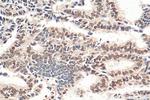 NACC1 Antibody in Immunohistochemistry (Paraffin) (IHC (P))