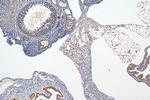 NACC1 Antibody in Immunohistochemistry (Paraffin) (IHC (P))