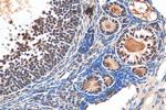 NACC1 Antibody in Immunohistochemistry (Paraffin) (IHC (P))