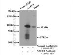 NACC1 Antibody in Immunoprecipitation (IP)