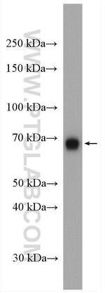 NACC1 Antibody in Western Blot (WB)