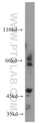 MT1-MMP Antibody in Western Blot (WB)