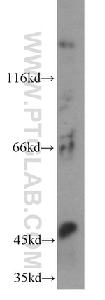 MT1-MMP Antibody in Western Blot (WB)