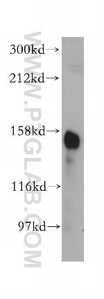 CD13 Antibody in Western Blot (WB)