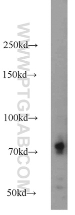 C1S Antibody in Western Blot (WB)