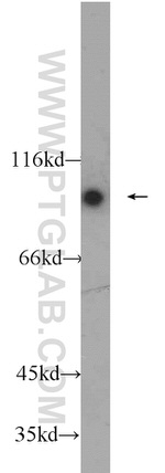 C1S Antibody in Western Blot (WB)