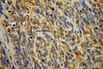 alpha Tubulin Antibody in Immunohistochemistry (Paraffin) (IHC (P))