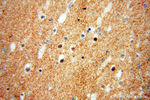 alpha Tubulin Antibody in Immunohistochemistry (Paraffin) (IHC (P))