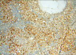 alpha Tubulin Antibody in Immunohistochemistry (Paraffin) (IHC (P))