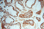 alpha Tubulin Antibody in Immunohistochemistry (Paraffin) (IHC (P))