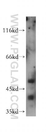 RBAP48 Antibody in Western Blot (WB)