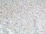 APOBEC3B Antibody in Immunohistochemistry (Paraffin) (IHC (P))