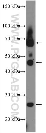 APOBEC3B Antibody in Western Blot (WB)