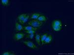 DHRS9 Antibody in Immunocytochemistry (ICC/IF)