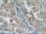 DHRS9 Antibody in Immunohistochemistry (Paraffin) (IHC (P))