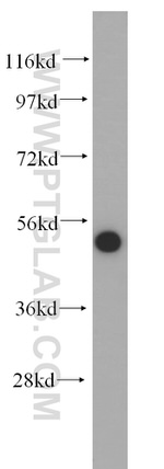 DHRS9 Antibody in Western Blot (WB)