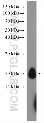 GP9 Antibody in Western Blot (WB)