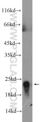 GP9 Antibody in Western Blot (WB)