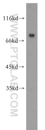 RINT1 Antibody in Western Blot (WB)