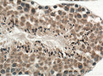 BBS5 Antibody in Immunohistochemistry (Paraffin) (IHC (P))