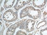 BBS5 Antibody in Immunohistochemistry (Paraffin) (IHC (P))