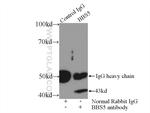 BBS5 Antibody in Immunoprecipitation (IP)