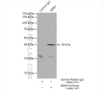 BBS5 Antibody in Immunoprecipitation (IP)