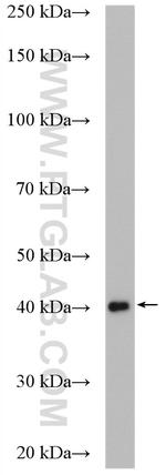 BBS5 Antibody in Western Blot (WB)