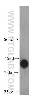 BBS5 Antibody in Western Blot (WB)