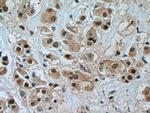 TFAP2C Antibody in Immunohistochemistry (Paraffin) (IHC (P))