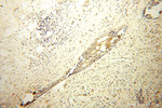 TFAP2C Antibody in Immunohistochemistry (Paraffin) (IHC (P))