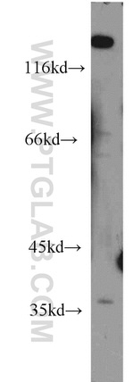 DEDD2 Antibody in Western Blot (WB)