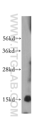 SDHC Antibody in Western Blot (WB)