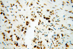 SF3B3 Antibody in Immunohistochemistry (Paraffin) (IHC (P))