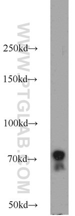 Perforin Antibody in Western Blot (WB)