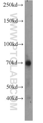 Perforin Antibody in Western Blot (WB)