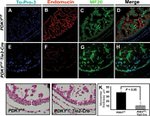 Endomucin Antibody in Immunohistochemistry (IHC)