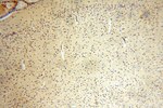 ERCC1 Antibody in Immunohistochemistry (Paraffin) (IHC (P))