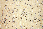 ERCC1 Antibody in Immunohistochemistry (Paraffin) (IHC (P))