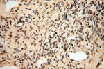 ERCC1 Antibody in Immunohistochemistry (Paraffin) (IHC (P))