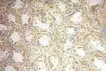 ERCC1 Antibody in Immunohistochemistry (Paraffin) (IHC (P))