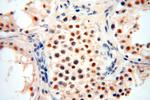 ERCC1 Antibody in Immunohistochemistry (Paraffin) (IHC (P))