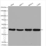 ERCC1 Antibody in Western Blot (WB)