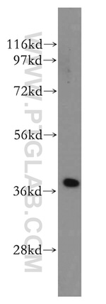 ERCC1 Antibody in Western Blot (WB)