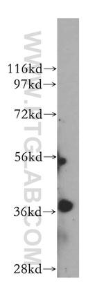 ERCC1 Antibody in Western Blot (WB)