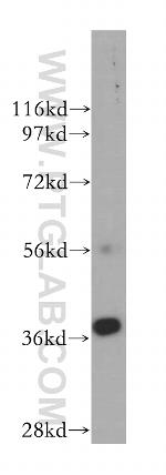 ERCC1 Antibody in Western Blot (WB)