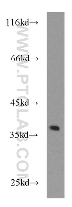 IKIP Antibody in Western Blot (WB)