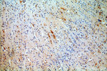 FBXO2 Antibody in Immunohistochemistry (Paraffin) (IHC (P))